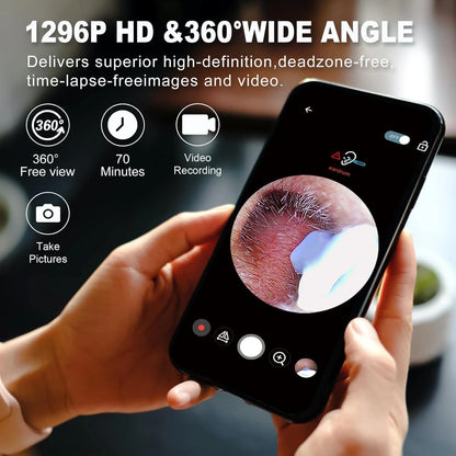 EarEase™ – Smart Visual Ear Wax Cleaner